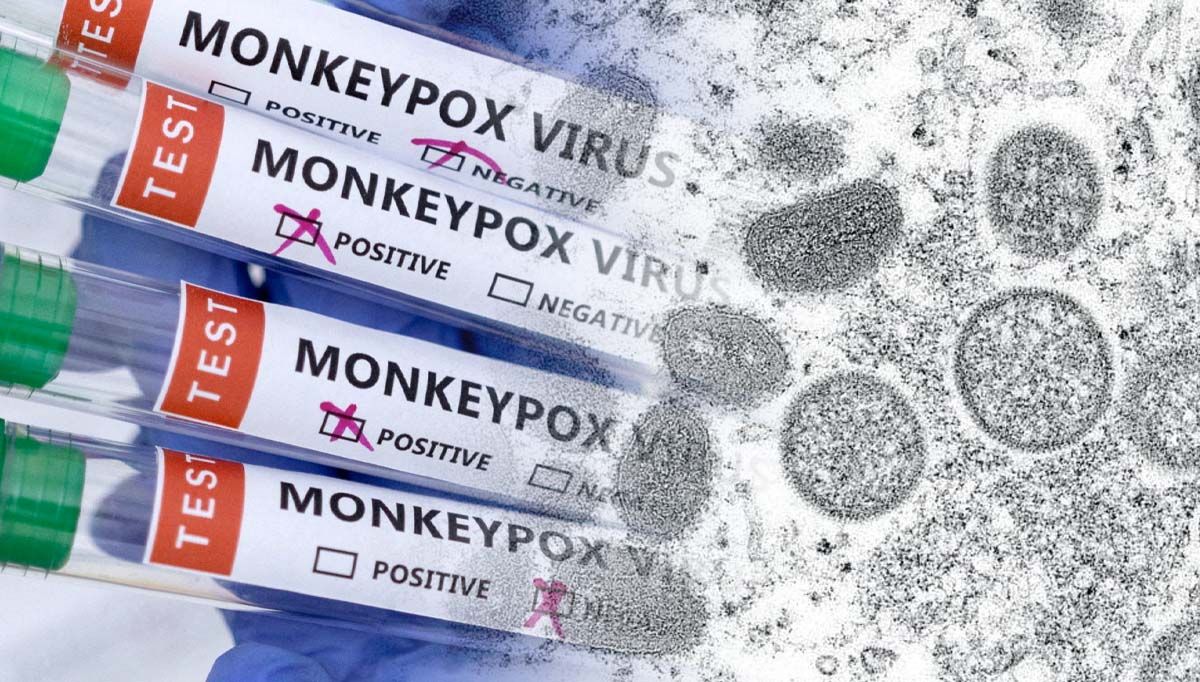 What to Know About the Monkeypox Outbreak